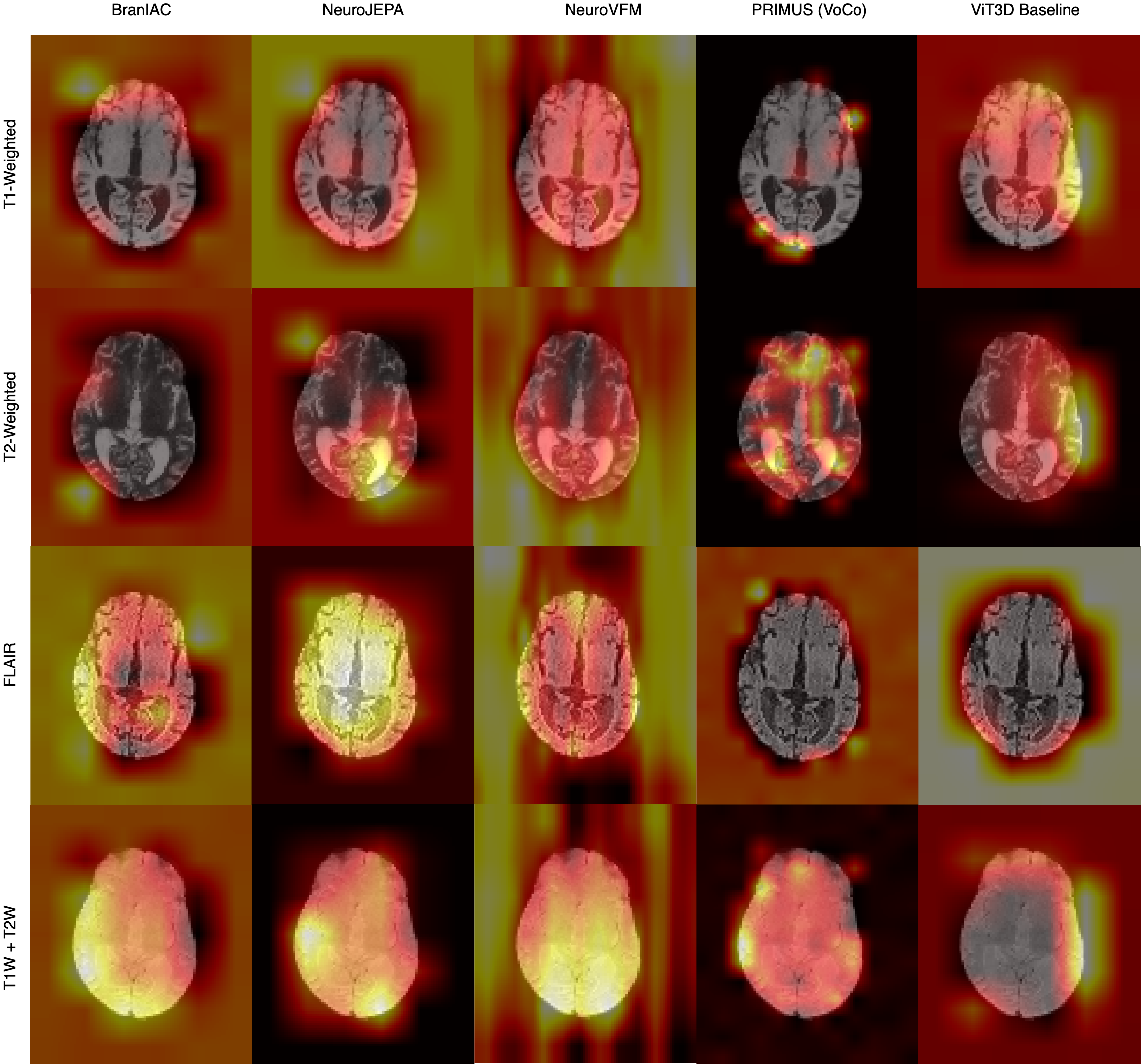Evaluating Neuroimaging Foundation Models on African Brain MRI