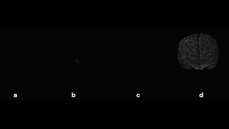 A Hitchhiker's Guide to 3D Medical Image Processing