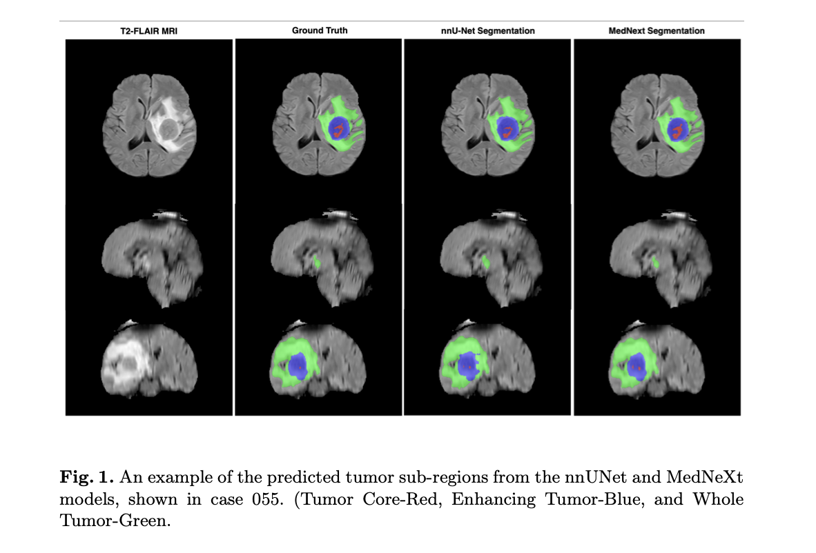 Brain Tumor Segmentation in Sub-Sahara Africa
