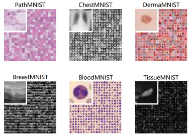 End-to-End Deep Learning Tutorial for Image Classification: Pneumonia Detection