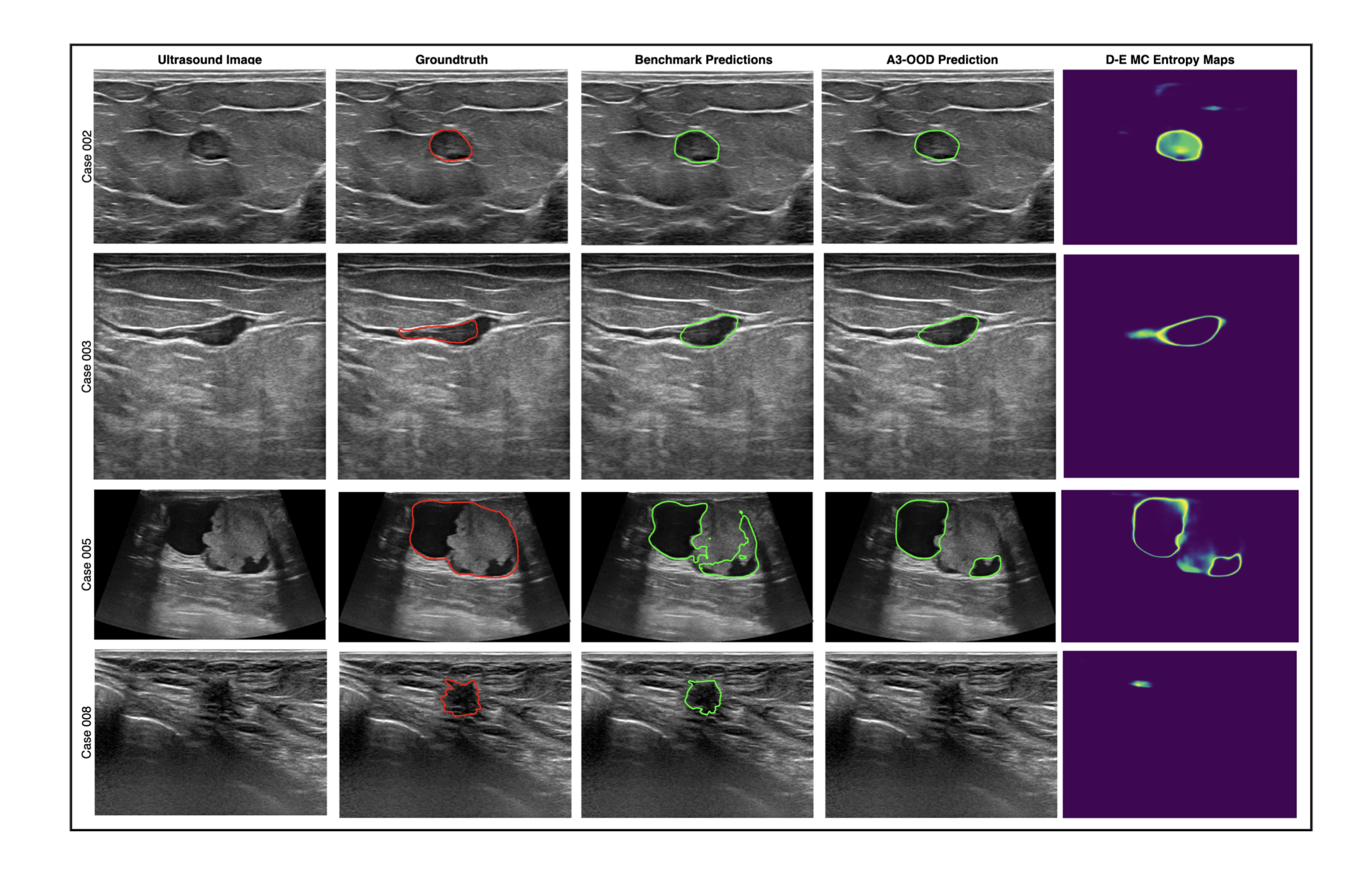Towards Trustworthy Breast Tumor Segmentation